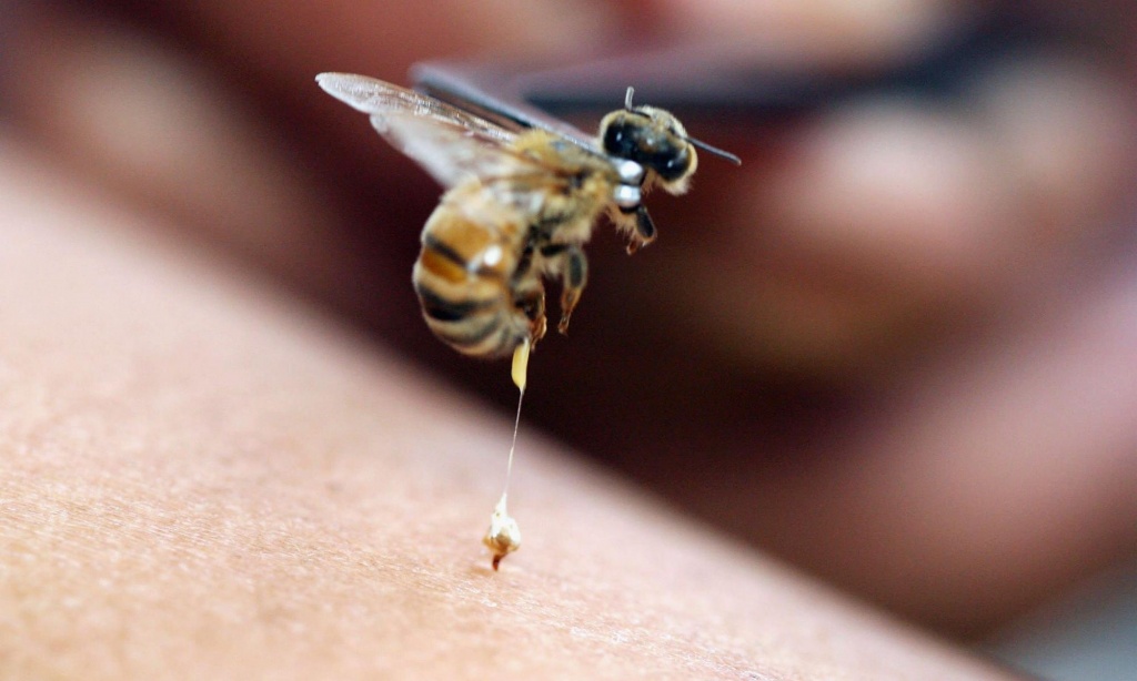 Пчелиный яд. Полезные лечебные свойства пчелиного яда. Оказание первой  медицинской помощи при укусе пчелы