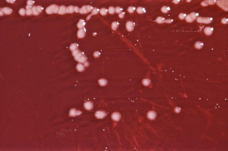 Колония бактерий Pseudomonas