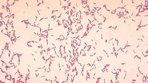 Бактерії Actinomyces bovis під мікроскопом