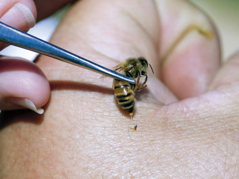 Добывание пчелиного яда.jpg