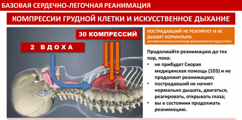 У разі зупинки серця та припинення дихання слід провести закритий масаж серця та штучне дихання (серцево-легенева реанімація)