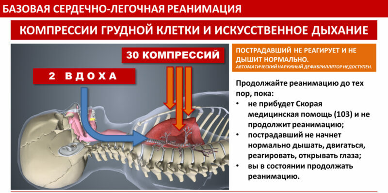 В случае остановки сердца и прекращении дыхания следует провести закрытый массаж сердца и искусственное дыхание (сердечно-легочная реанимация)